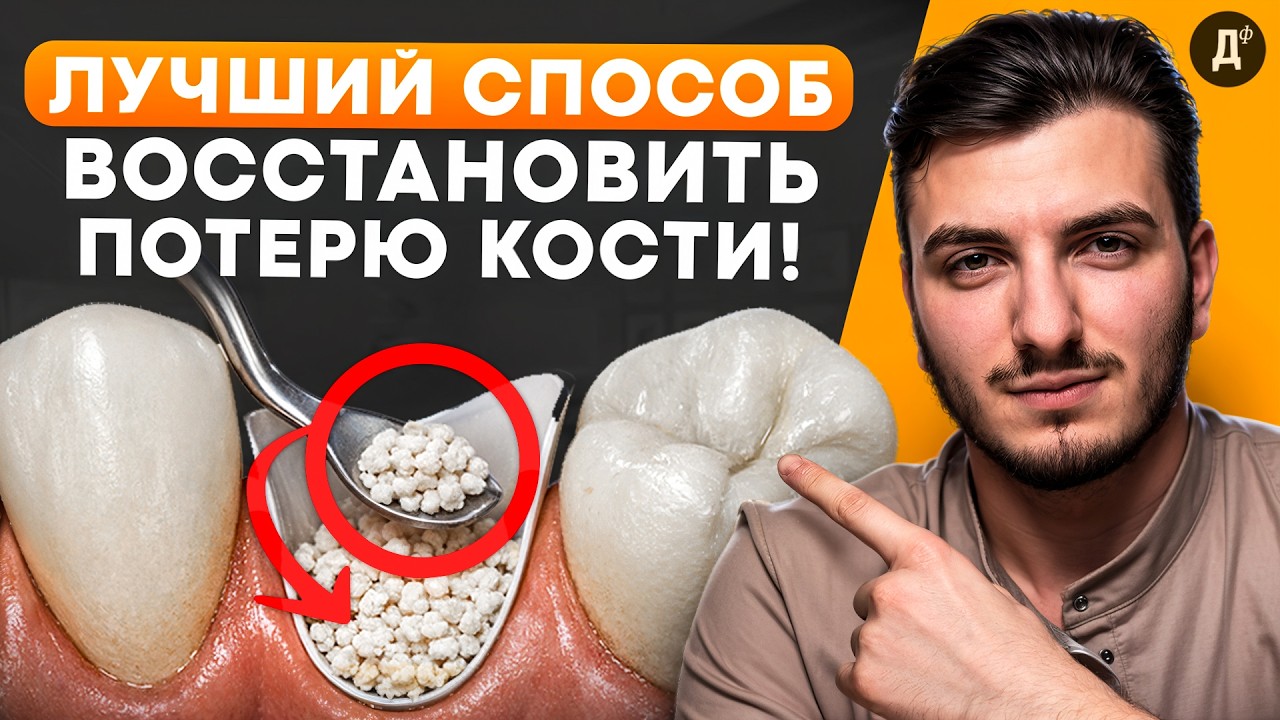 Что нужно знать о СИНУС ЛИФТИНГЕ и какие последствия ЖДУТ ПАЦИЕНТА?