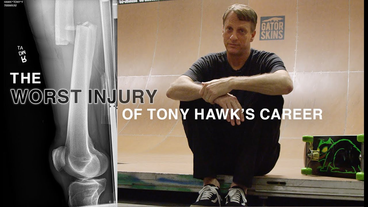 Tony Hawk Breaks Down The Worst Slam Of His Career