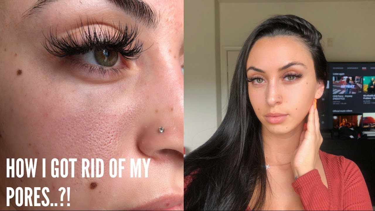 HOW I GOT RID OF MY PORES..?!