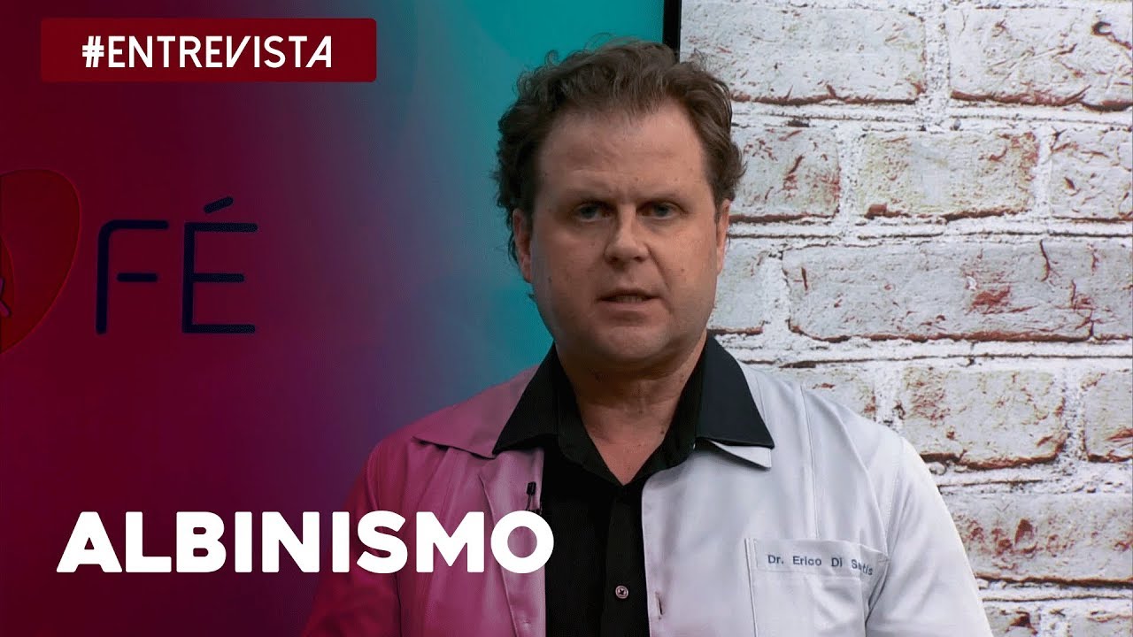 Saiba tudo sobre Albinismo