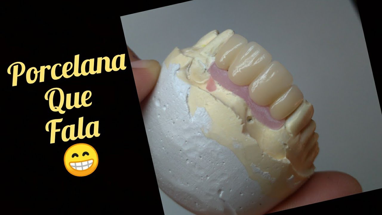 Cerâmica Noritake Ex3- Dicas de aplicação