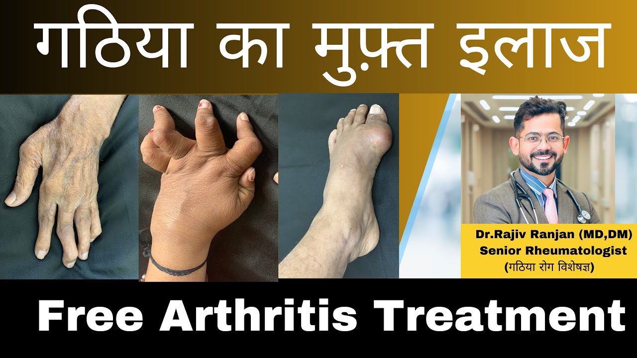 गठिया का मुफ़्त इलाज | Free Arthritis Treatment in India