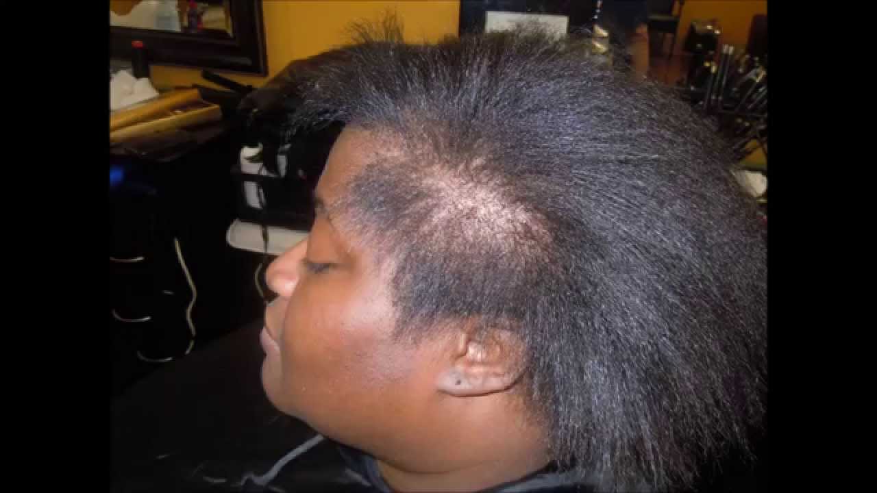 MICRO LINK HAIRLINE EXTENDER FOR SEW INS AND WIGS