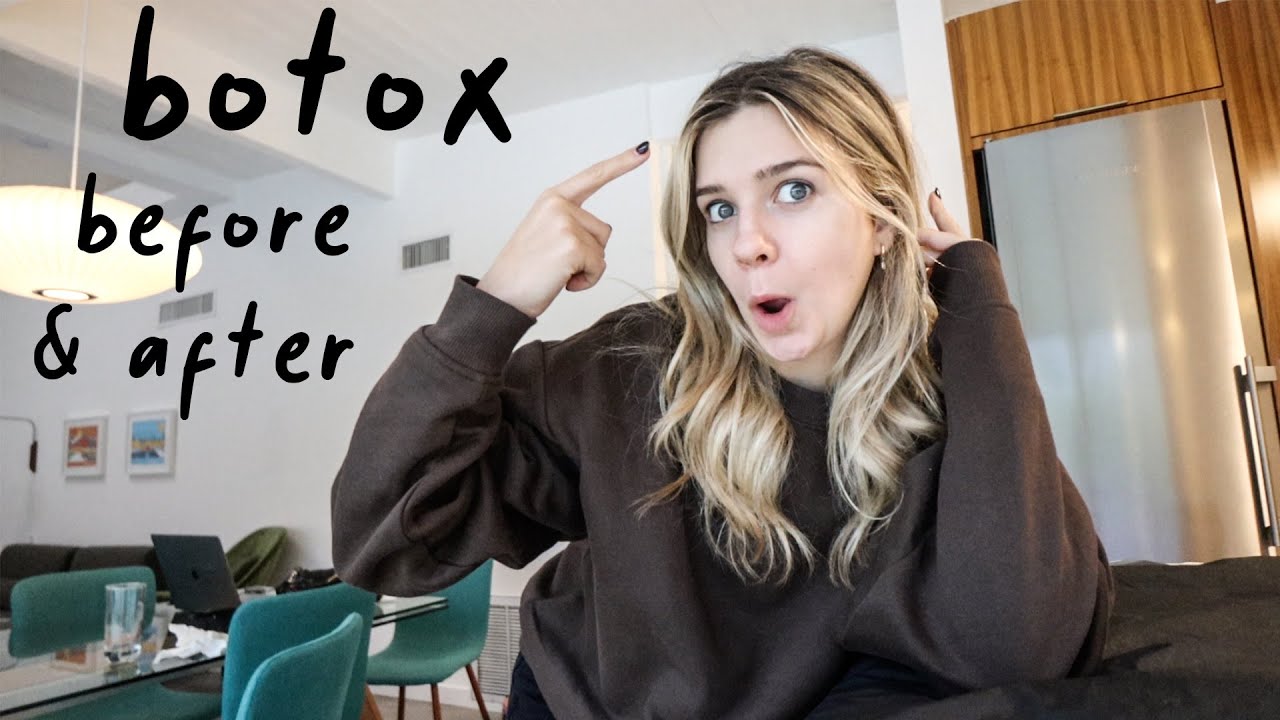 I got BOTOX + a few days in LA!