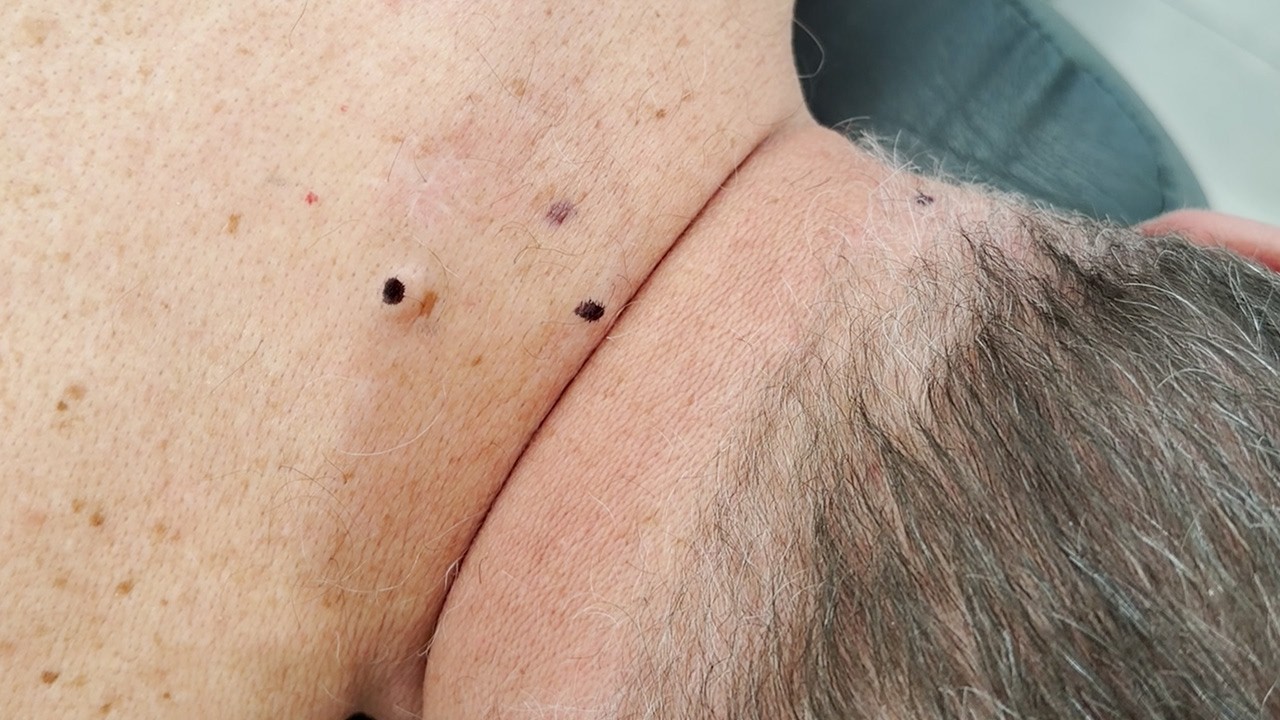 TRZY W CENIE JEDNEJ CYSTY!