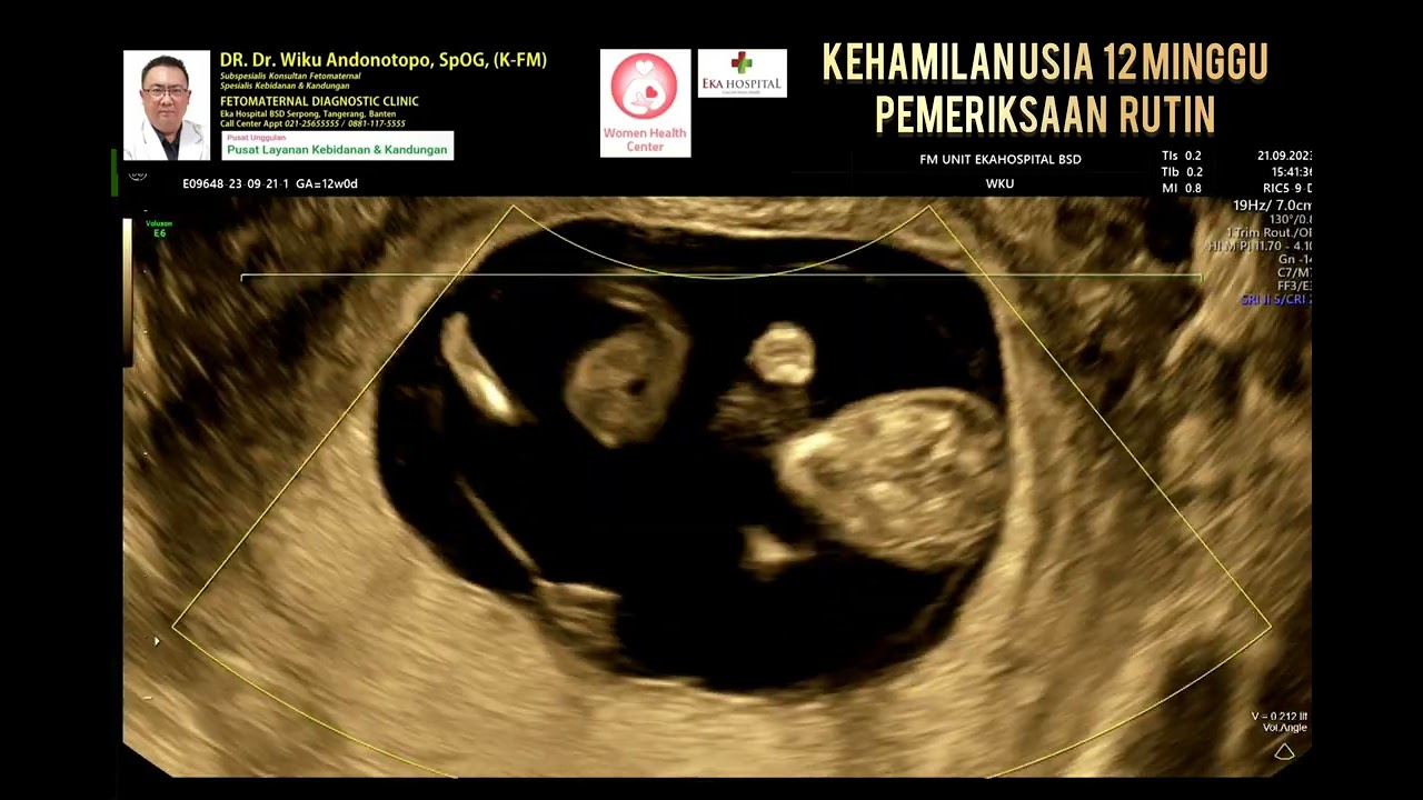 Pemeriksaan kehamilan 12 minggu
