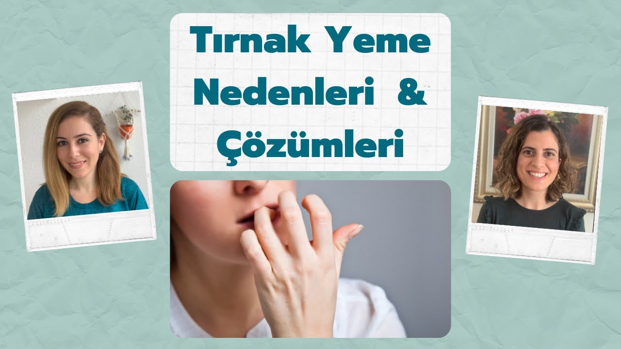Tırnak Yeme Nasıl Bırakılır? - Tırnak Yeme Nedenleri ve Çözümleri