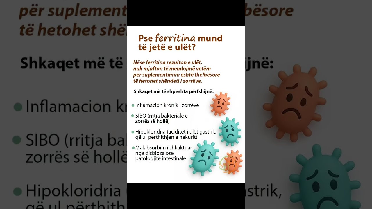 A JU BIEN FLOK&Euml;T? Ja nj&euml; arsye p&euml;rse...