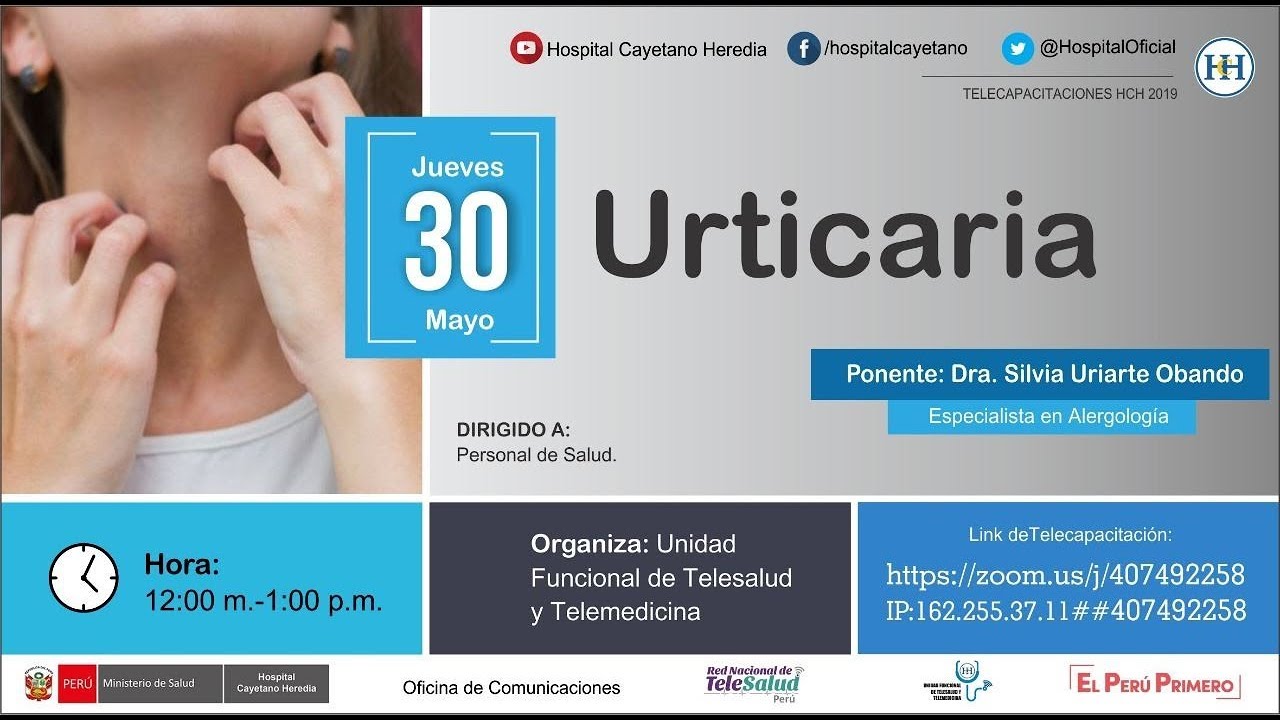 URTICARIA