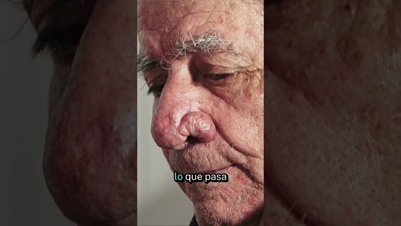 🧠 &iquest;Tristeza o depresi&oacute;n en la vejez No es lo mismo  Y s&iacute;, puede tratarse  💬