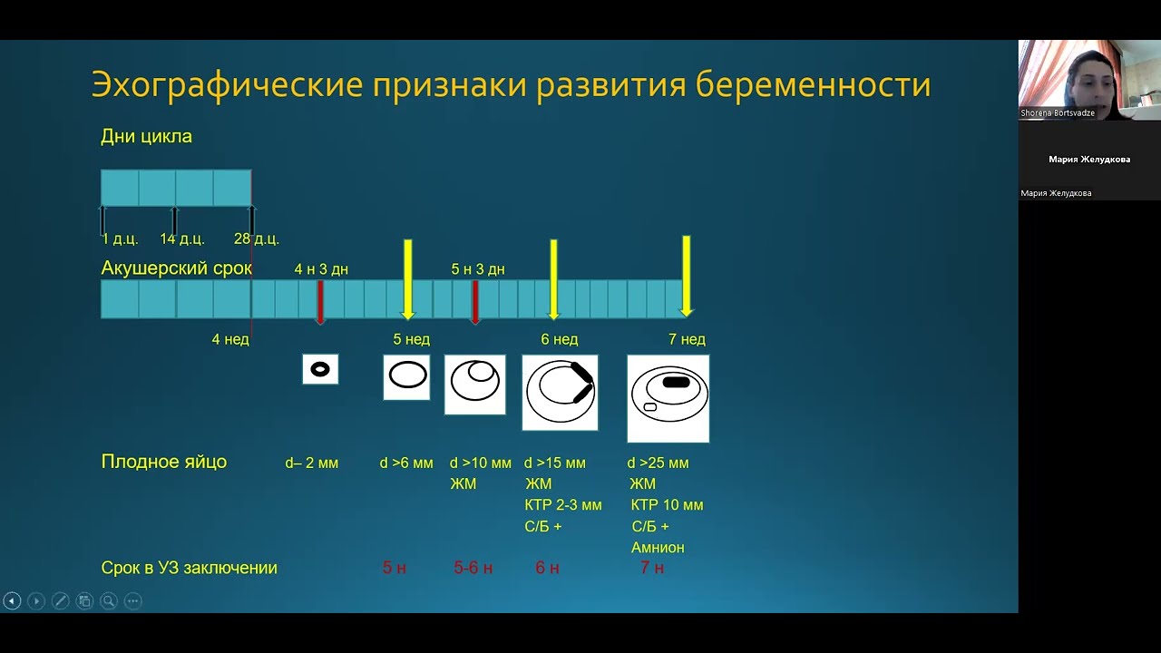 Борцвадзе Шорена Нугзаровна 