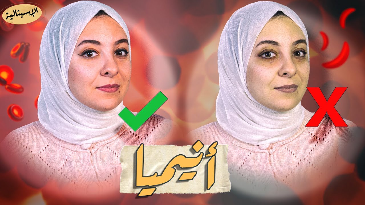 السبب وراء كل أنواع الأنيميا ! | الوقاية والعلاج بالتفصيل | الاسبتالية