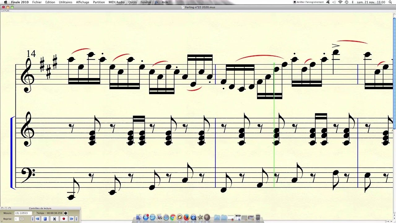 Projet FERLING Etude n°22