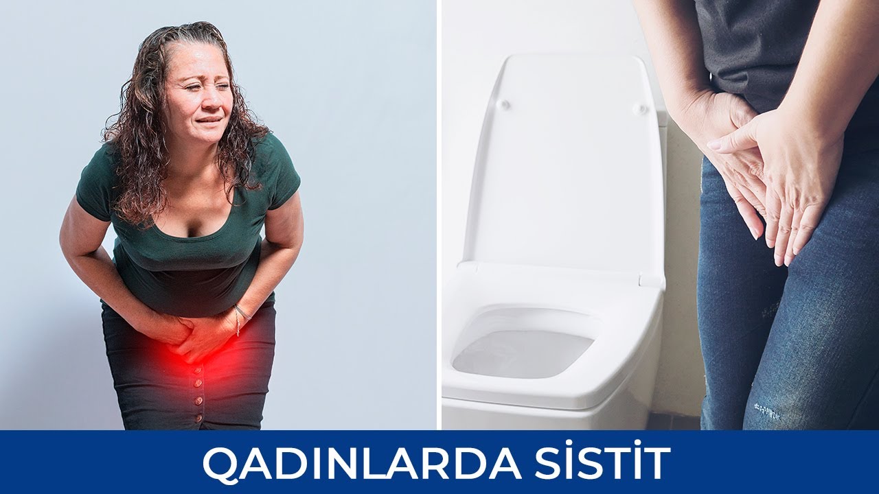 Qadınlarda Sistit Xəstəliyi - M&uuml;alicəsi Necə Edilməlidir -  Elza Binnətova ( Uroloq )