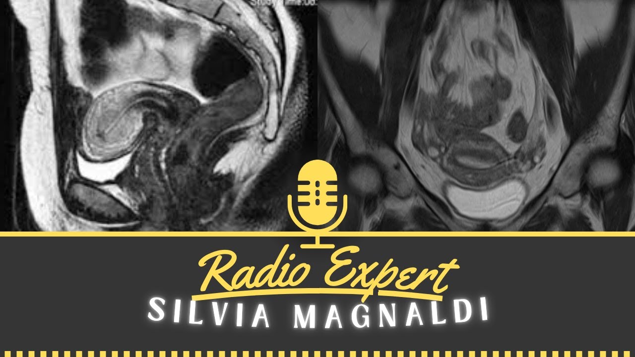 #RadioExpert - anatomia RM della pelvi femminile con Silvia Magnaldi