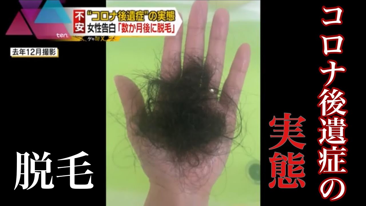 終わらないコロナ後遺症　脱毛・倦怠感・嗅覚・味覚異常…その実態は