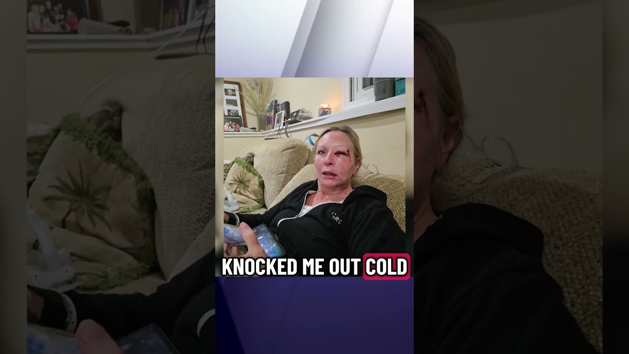 North suburban mother of 11 recovering after attack by serial woman puncher&hellip;