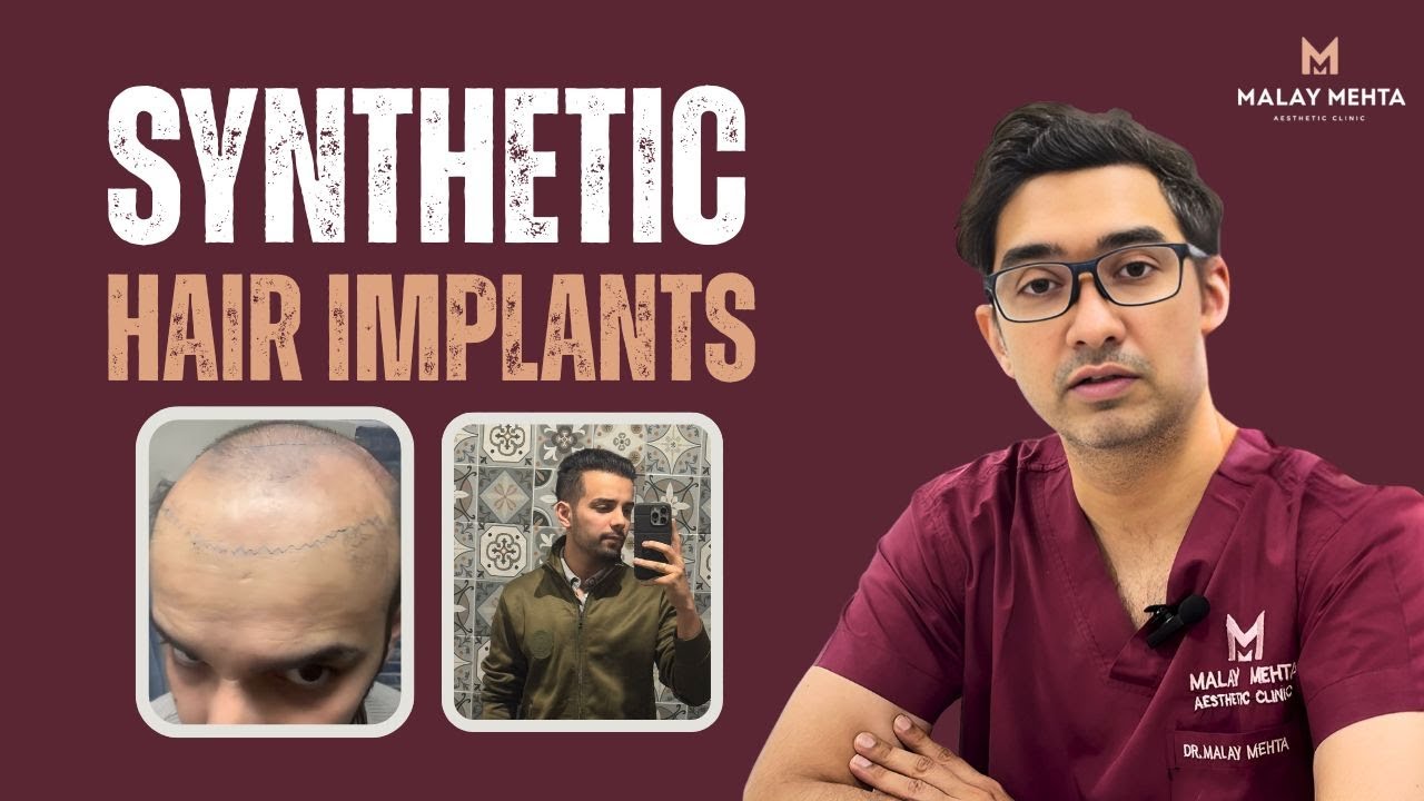 🚨 Synthetic Hair Transplant EXPOSED! Shocking Results & Side Effects 😱💉 | Dr. Malay Mehta Explains