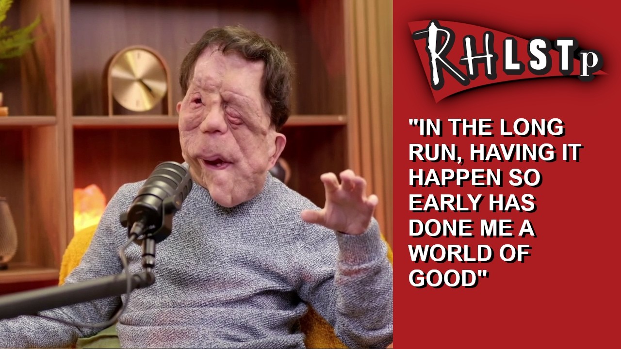 Adam Pearson on neurofibromatosis, and being a public disability rights activist - from RHLSTP 599