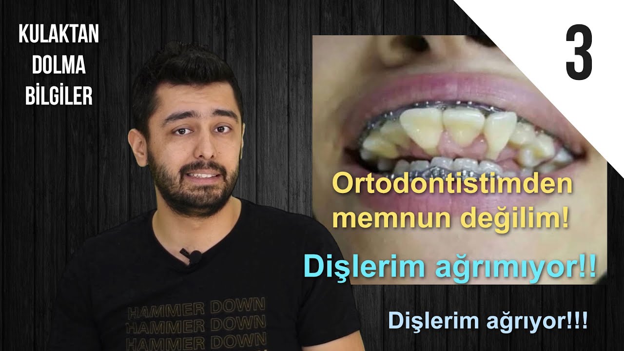 KDB 3 - Bukkal ortodonti, şeffaf plak, lingual karşılaştırma, tel tedavisinde dişler ağrır mı?