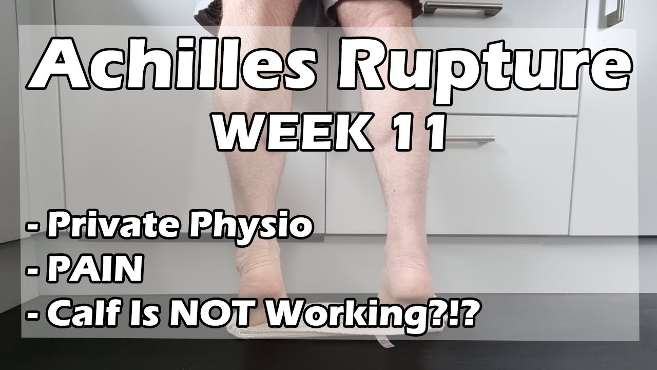 Achilles Rupture Recovery - Week 11 - Non Surgical