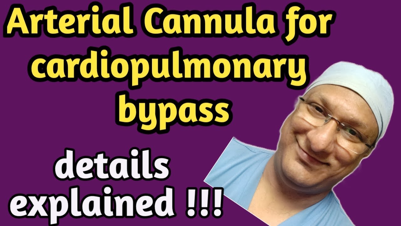 Arterial cannulae for cardiopulmonary bypass: Understanding made easy.