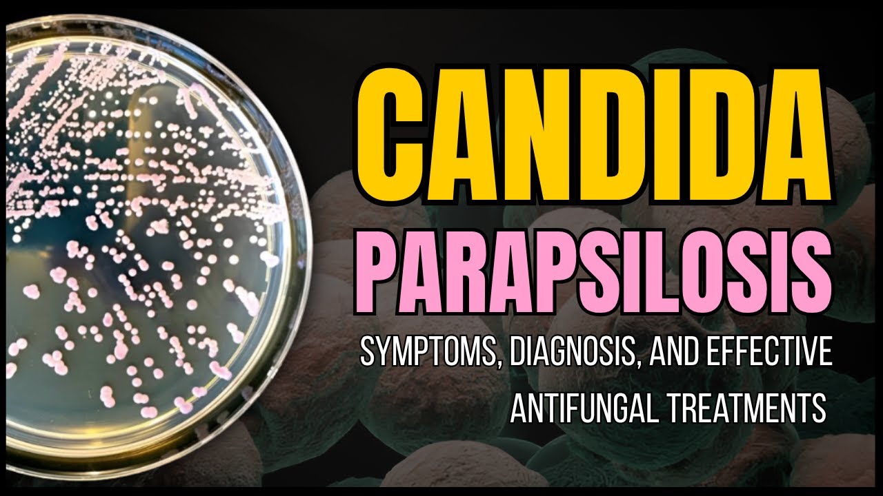 Candida parapsilosis: Symptoms, Diagnosis, and Effective Antifungal Treatments
