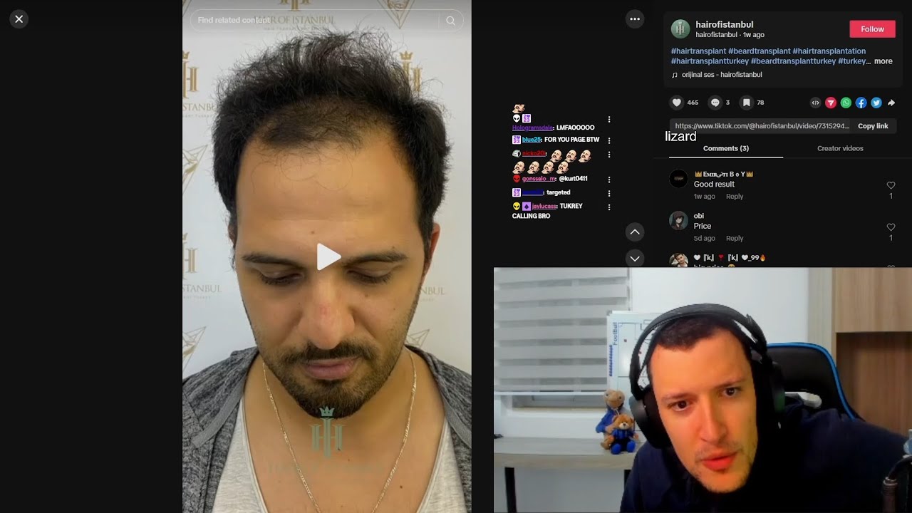 Kurt's TikTok FYP gets very specific & attacks him...