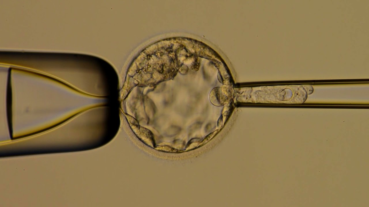 Day 5 Embryo Biopsy