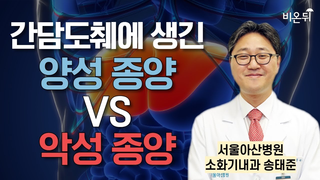 간담도췌에 생긴 양성 종양 vs 악성 종양 구별법 / 서울아산병원 소화기내과 송태준