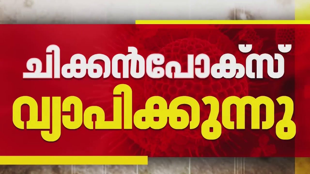 സംസ്ഥാനത്ത് ചിക്കന്‍പോക്‌സ് വ്യാപിക്കുന്നു; 50 ദിവസത്തിനിടെ രോഗബാധ 7,531 പേര്‍ക്ക്| Chickenpox