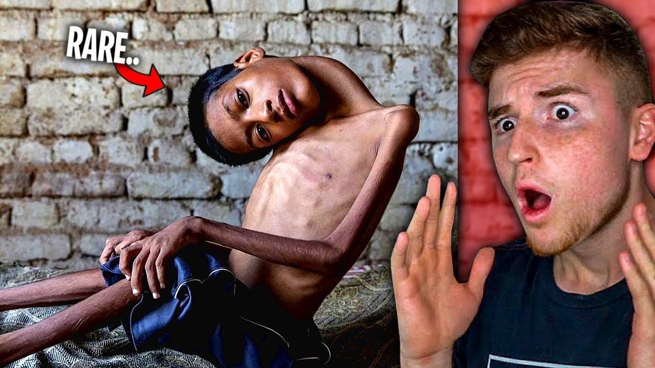 You WON'T BELIEVE These RARE Kids Exist!