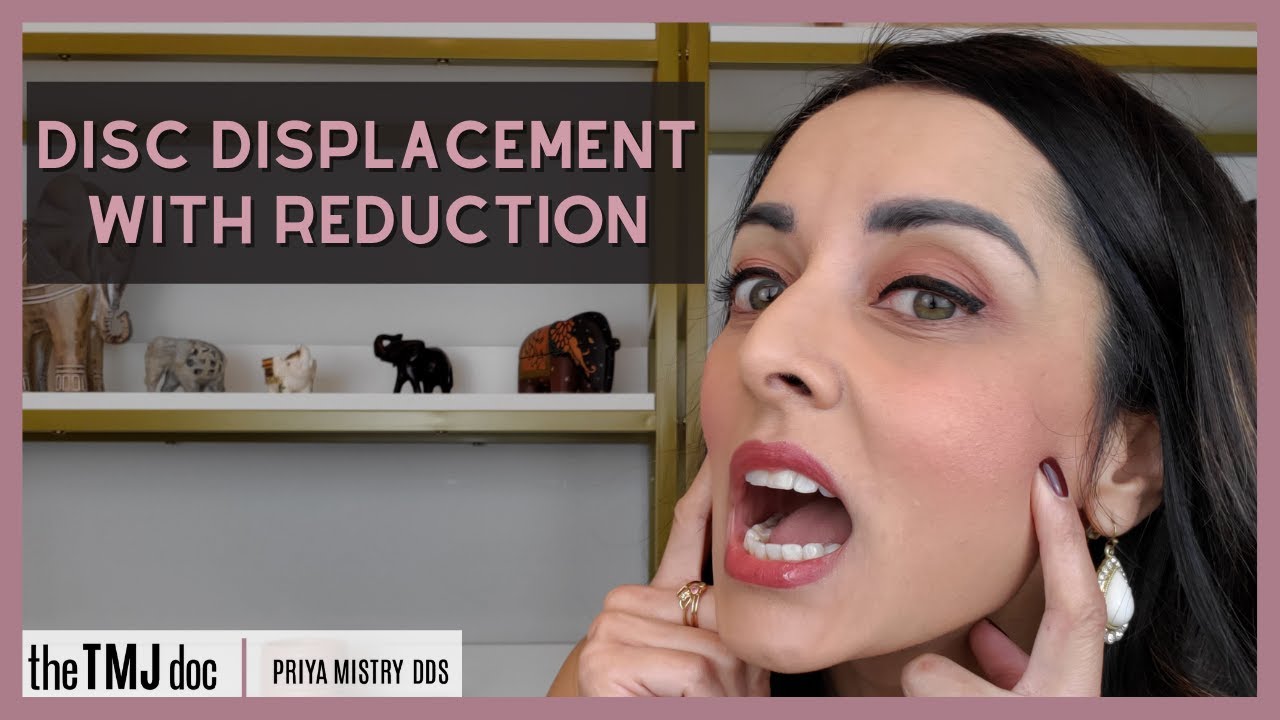 Смещение диска с редукцией - Прия Мистри, DDS (документ ВНЧС) #tmj #jawpopping #jawclicking