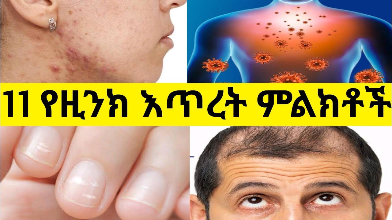 የዚንክ እጥረት 11 ዋና ዋና ምልክቶች | 11 Warning sign of zinc deficiency