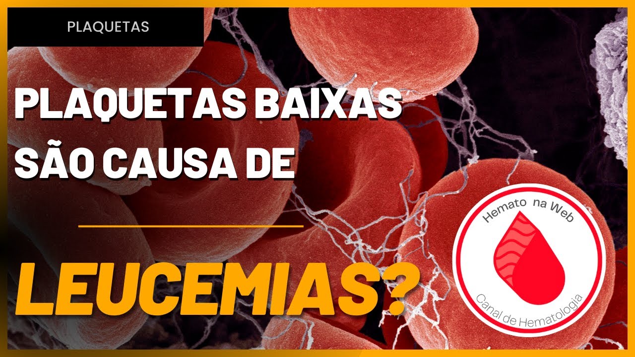 PLAQUETAS BAIXAS são causas de LEUCEMIA? | Geydson Cruz [MD,MSc]