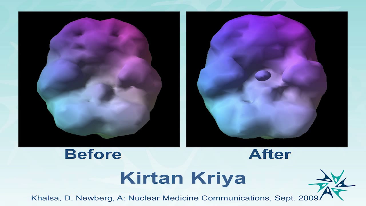 The Role of Meditation in Restoring and Enhancing Brain Function