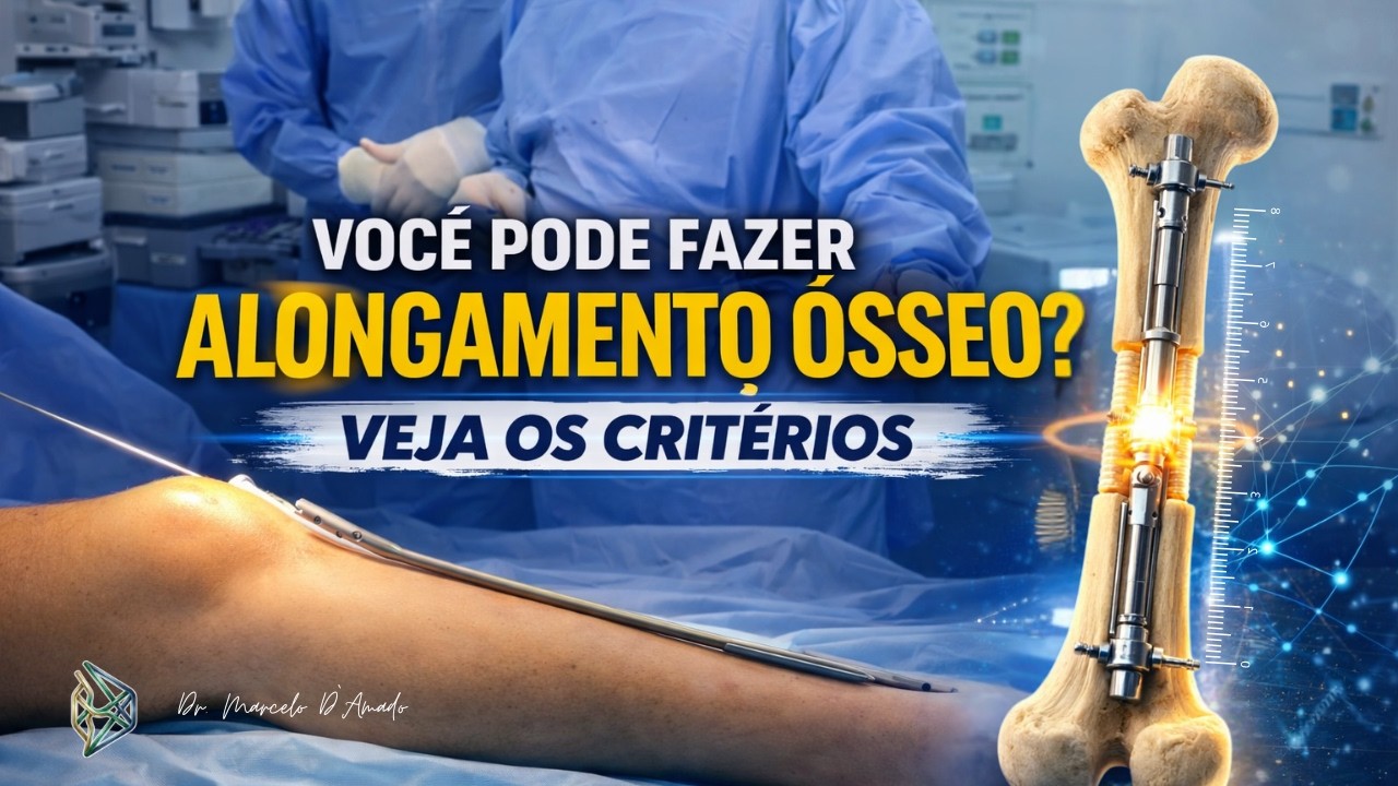 Quem Pode Fazer Alongamento Ósseo? Critérios Médicos Para Crescer Depois de Adulto