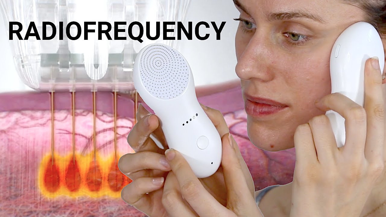 Radiofrequency Skin 'Tightening' Treatments - Do They Really Work & If So, How? (Nebulyft Science)