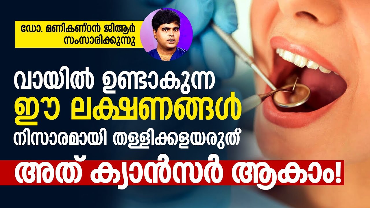 Oral Cancer | വായിൽ ഉണ്ടാകുന്ന ഈ ലക്ഷണങ്ങൾ നിസാരമായി തള്ളിക്കളയരുത്, അത് ക്യാൻസർ ആകാം!