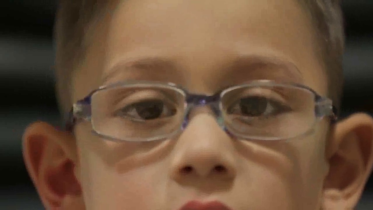 Endotropia acomodativa. Los ojos se desvían hacia adentro