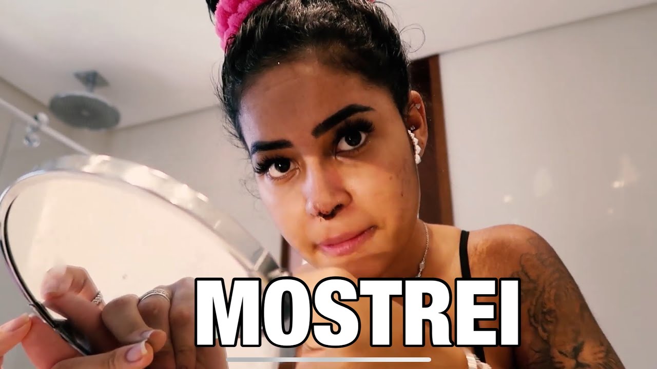 O ENXERTO DO MEU NARIZ