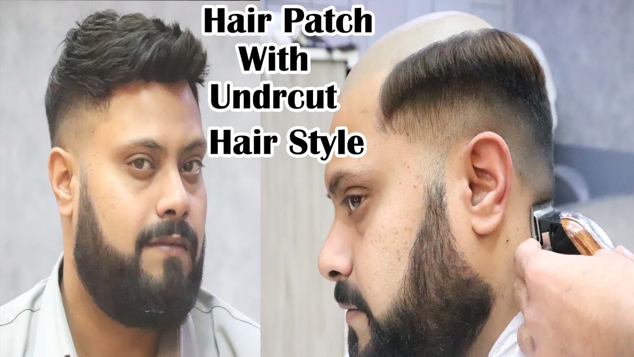 Hair patch with undercut hair style in delhi hair fixing by Abdul Rehman Call Now - 9873152223