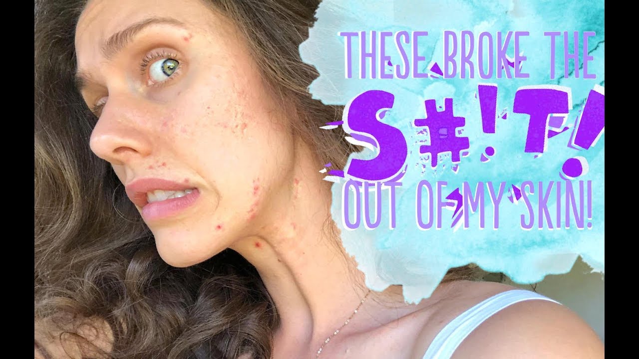 10 ACNE PRODUCTS THAT BROKE ME OUT, OR HELPED MY SKIN