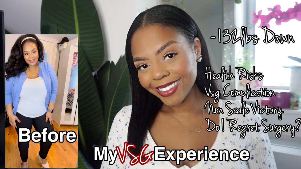 MY VSG EXPERIENCE | FIRST 3 MONTHS | -132LBS DOWN
