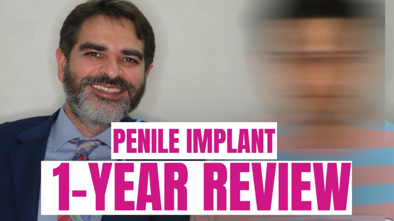 penile implant - patient review 1 year after Indian shah prosthesis