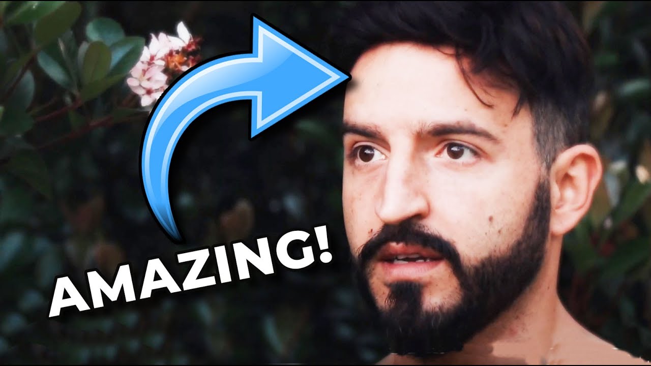 Stage PERFORMER'S Hair System Changed HIS LIFE! 👀 [This hair restoration story is awesome]