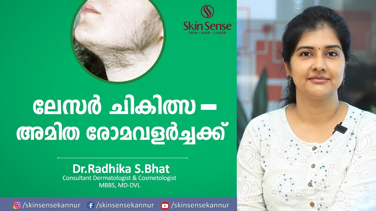 ലേസർ ചികിത്സ - അമിത രോമ വളർച്ചക്ക് | LASER HAIR REDUCTION | Skin Sense | Dr. Radhika S.Bhat | Kannur