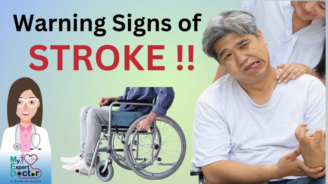 Warning Signs of stroke !! Recognise STROKE symptoms &lsquo;FAST&rsquo; & Save Lives !!