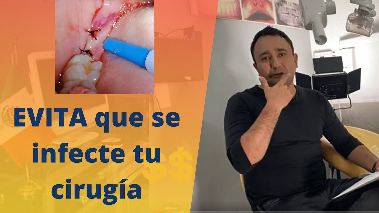 ¿Qué debes haces DESPUES de una CIRUGIA BUCAL?