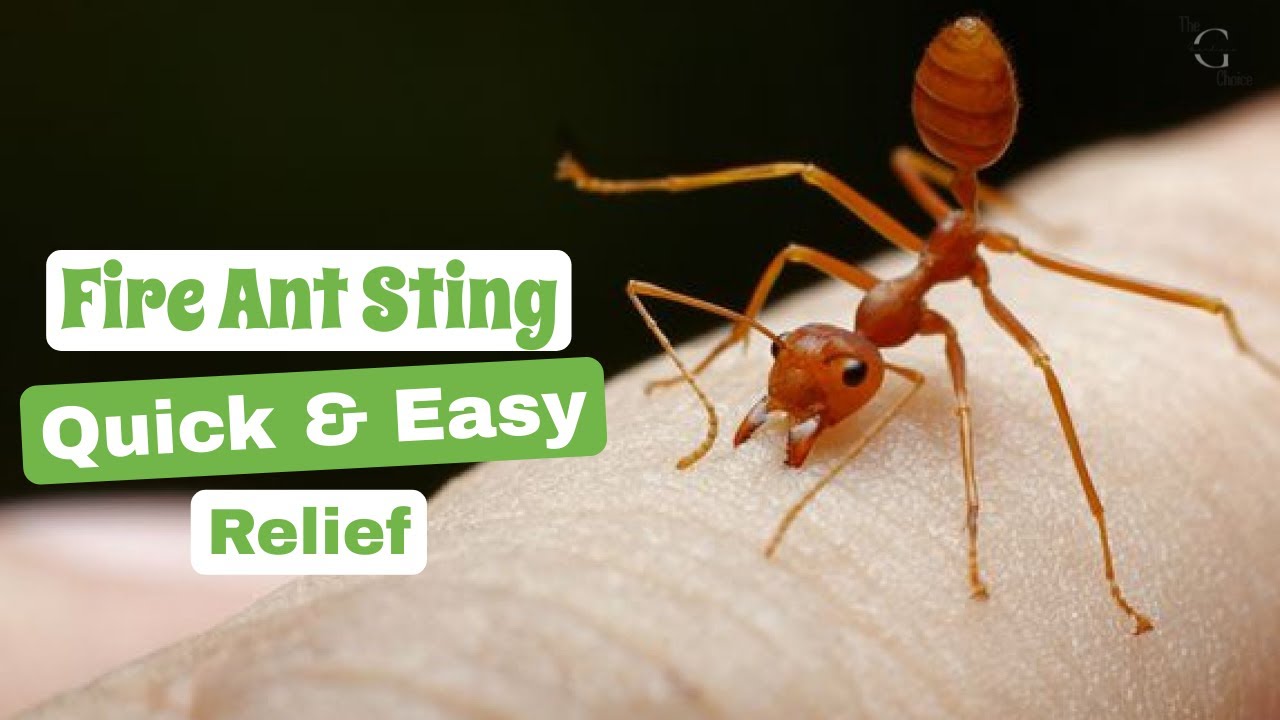Fire Ant Sting Relief: How to Treat and Soothe the Pain - Quick & Easy | The Guardians Choice
